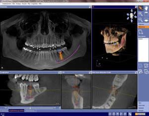 Ny teknologi -3d-rontgren